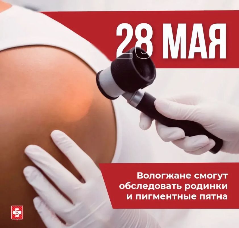 День диагностики меланомы пройдет 28 мая в Вологодском областном кожно-венерологическом диспансере