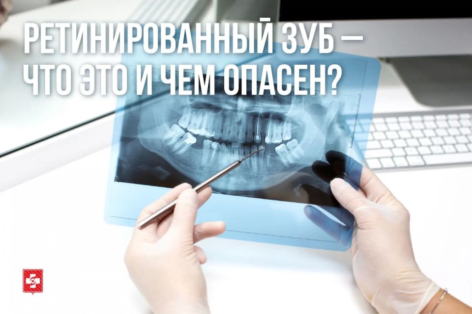 Ретинированный зуб: что это и почему нельзя игнорировать?