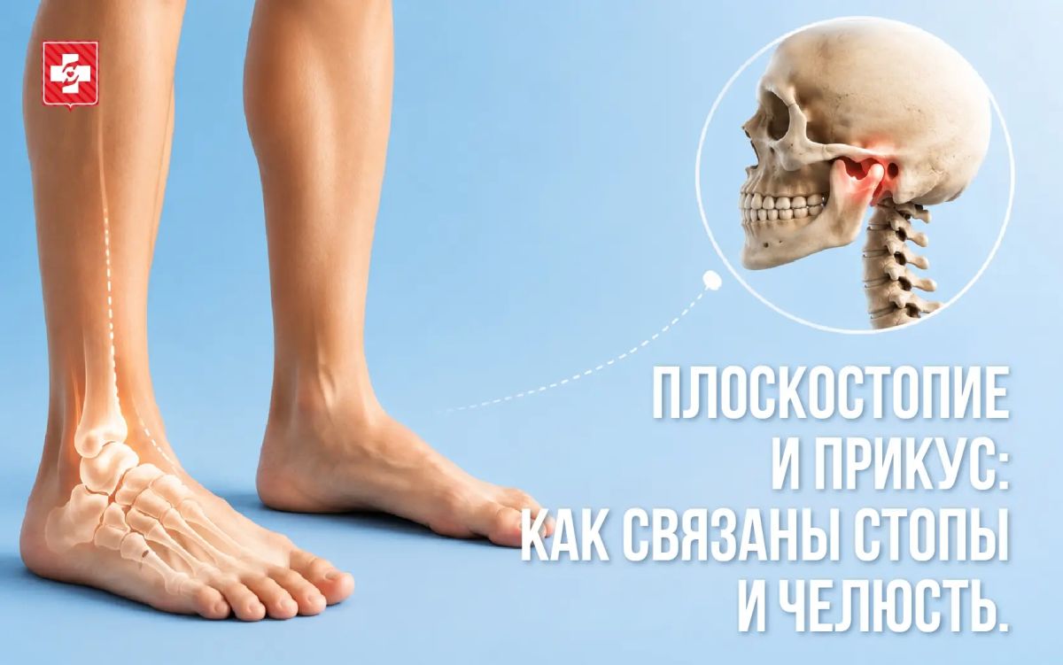 Плоскостопие и прикус: как связаны стопы и челюсть