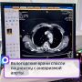 Вологодские врачи спасли пациентку с аневризмой аорты