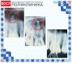 Своевременное обращение к врачу — шанс сохранить свой зуб