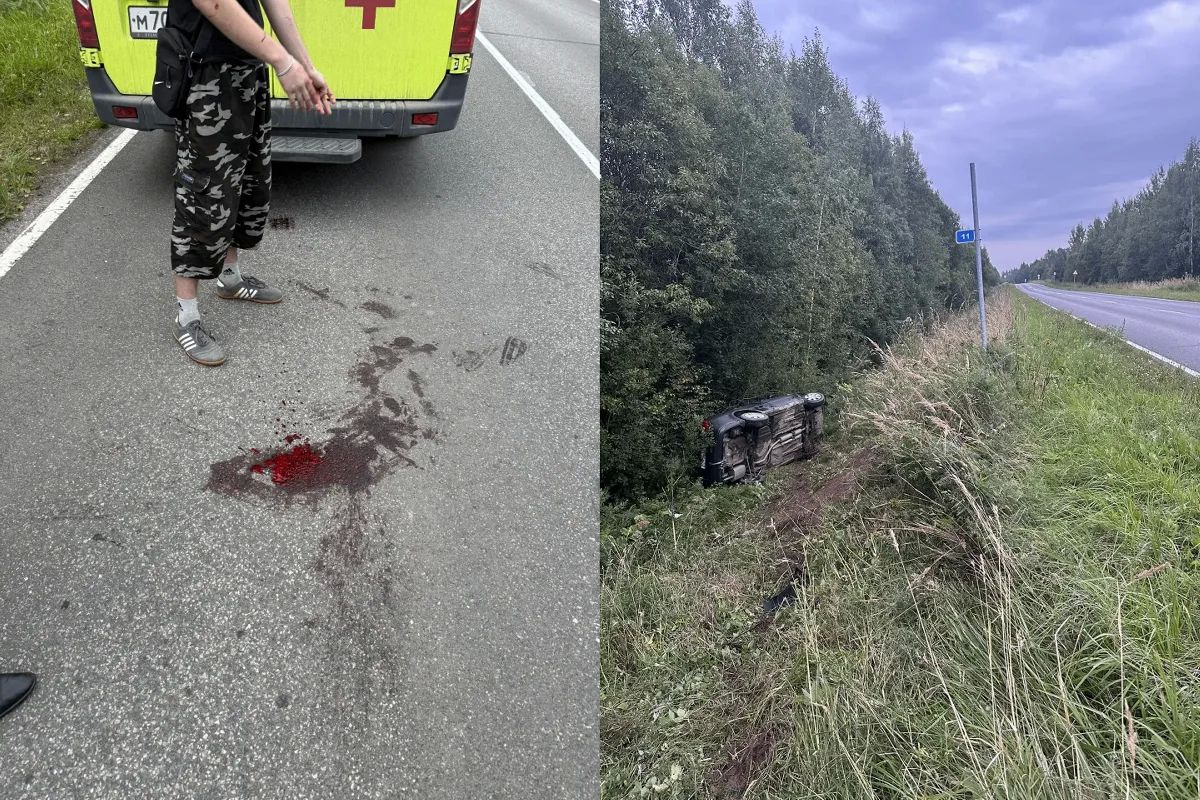 Сбитого под Вологдой 10-летнего ребенка госпитализировали в больницу