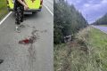Сбитого под Вологдой 10-летнего ребенка госпитализировали в больницу