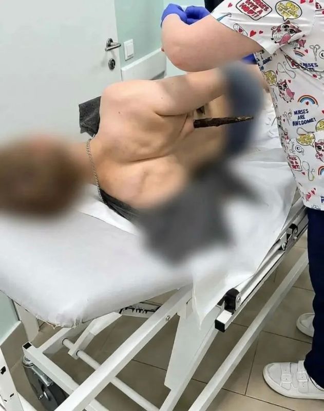 Врачи Вологодской областной больницы №3 спасли 18-летнего череповчанина с проникающим ранением грудной клетки