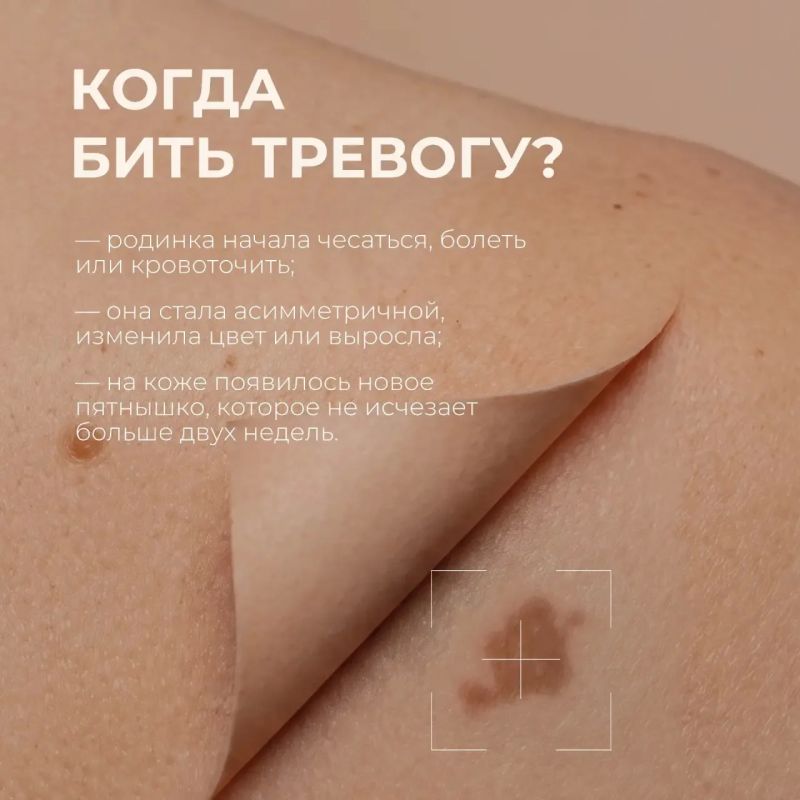 Что важно знать о меланоме Что важно знать о меланоме
